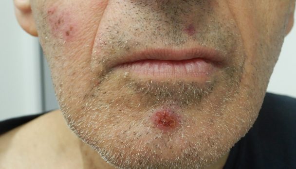 ep 6. Lips what should we be thinking about