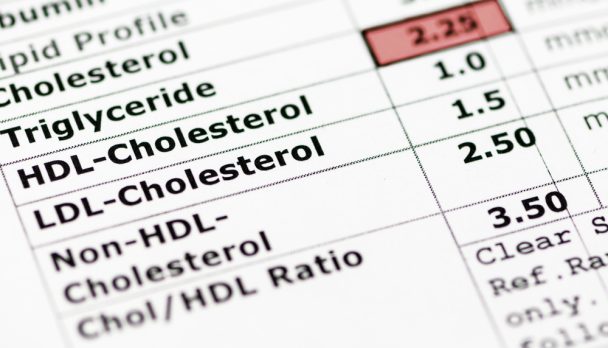 Blood,Chemistry,Report,Showing,A,Lipid,Profile,With,High,Triglyceride