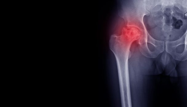 shutterstock_1537934720